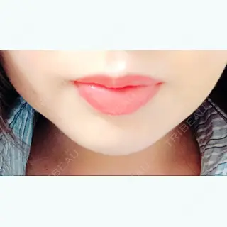 4日目の経過画像（1枚目）