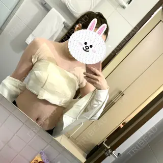 2日目の経過画像（1枚目）