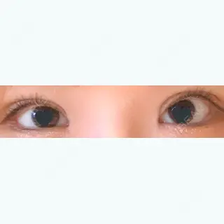 23日目の経過画像（1枚目）