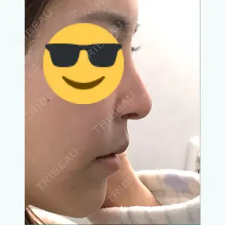 62日目の経過画像（1枚目）