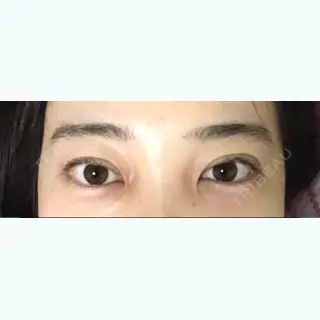 423日目の経過画像（1枚目）
