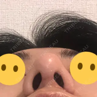 26日目の経過画像（3枚目）