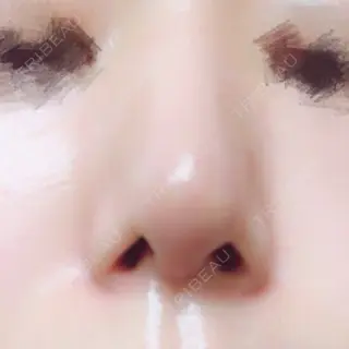 9日目の経過画像（1枚目）