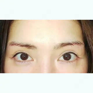 73日目の経過画像（1枚目）