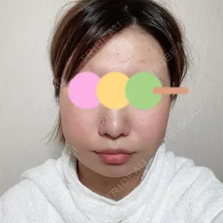 2日目の経過画像（1枚目）