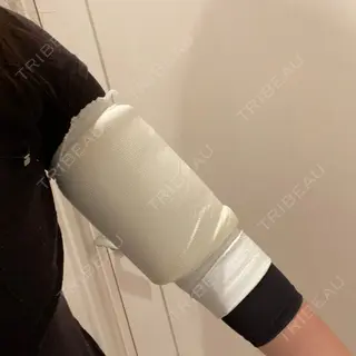 1日目の経過画像（2枚目）
