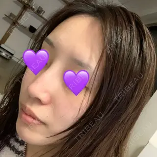 16日目の経過画像（2枚目）