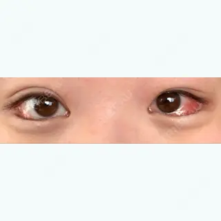 8日目の経過画像（1枚目）