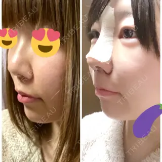 3日目の経過画像（1枚目）