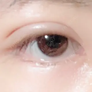 6日目の経過画像（1枚目）