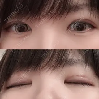 7日目の経過画像（1枚目）