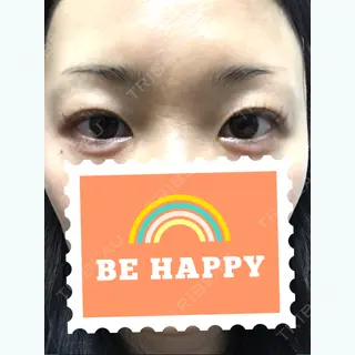 0日目の経過画像（1枚目）