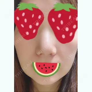 7日目の経過画像（1枚目）