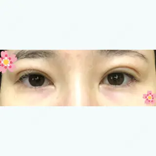 12日目の経過画像（1枚目）