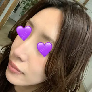 18日目の経過画像（2枚目）