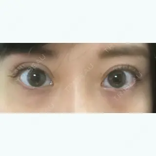9日目の経過画像（1枚目）