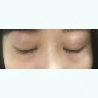 9日目の経過画像（2枚目）