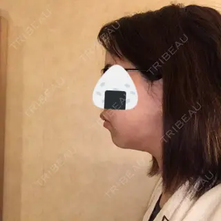 1日目の経過画像（1枚目）