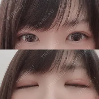 9日目の経過画像（2枚目）