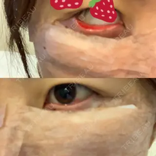 0日目の経過画像（2枚目）