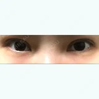 37日目の経過画像（1枚目）