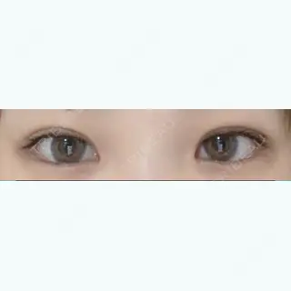 3日目の経過画像（1枚目）