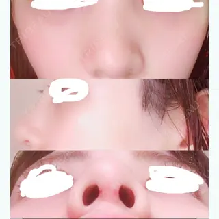 10日目の経過画像（1枚目）