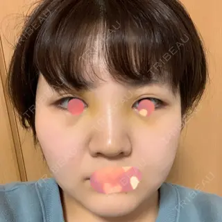 3日目の経過画像（1枚目）