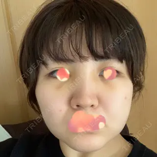 4日目の経過画像（1枚目）