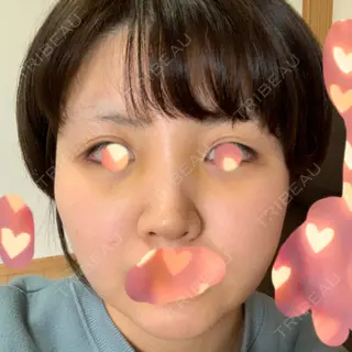 6日目の経過画像（1枚目）