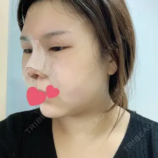 2日目の経過画像（2枚目）