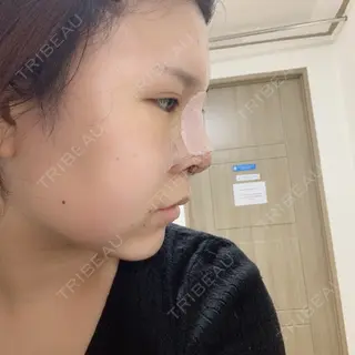 2日目の経過画像（2枚目）