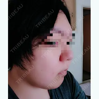 10日目の経過画像（3枚目）