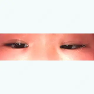 34日目の経過画像（2枚目）