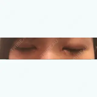 7日目の経過画像（2枚目）