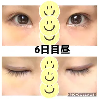 6日目の経過画像（1枚目）