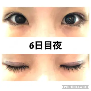6日目の経過画像（2枚目）