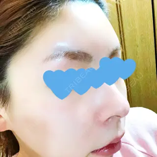 8日目の経過画像（2枚目）