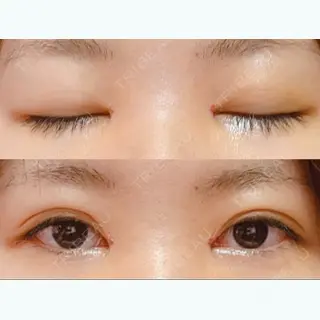4日目の経過画像（1枚目）