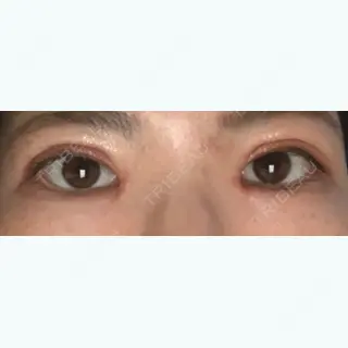 22日目の経過画像（1枚目）