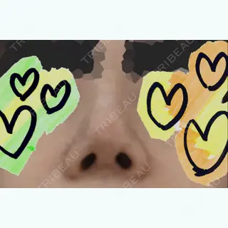9日目の経過画像（3枚目）