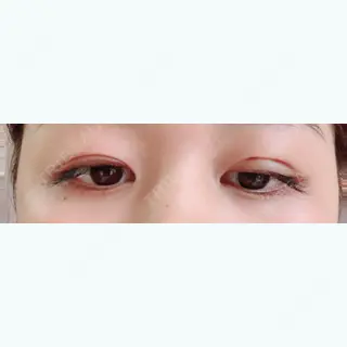 3日目の経過画像（1枚目）