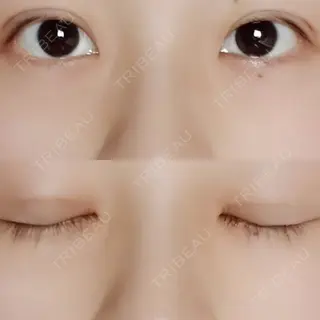 22日目の経過画像（1枚目）
