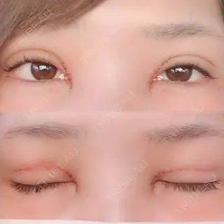 2日目の経過画像（1枚目）