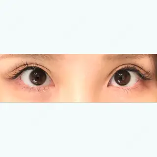 78日目の経過画像（1枚目）