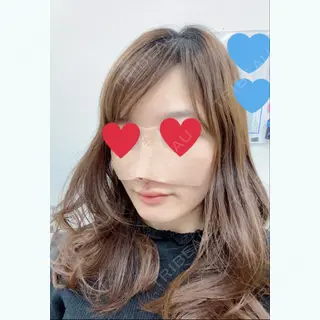 0日目の経過画像（2枚目）