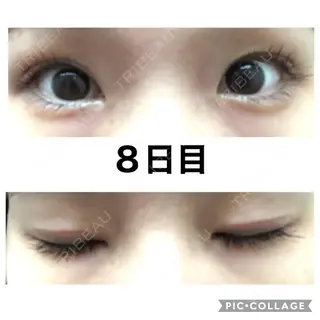 8日目の経過画像（1枚目）