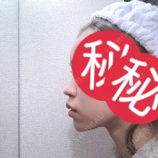 0日目の経過画像（1枚目）