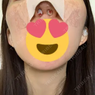 0日目の経過画像（3枚目）