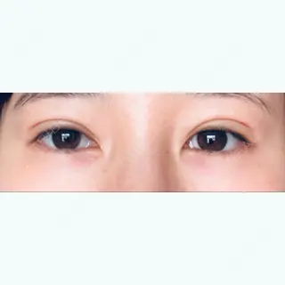 19日目の経過画像（1枚目）